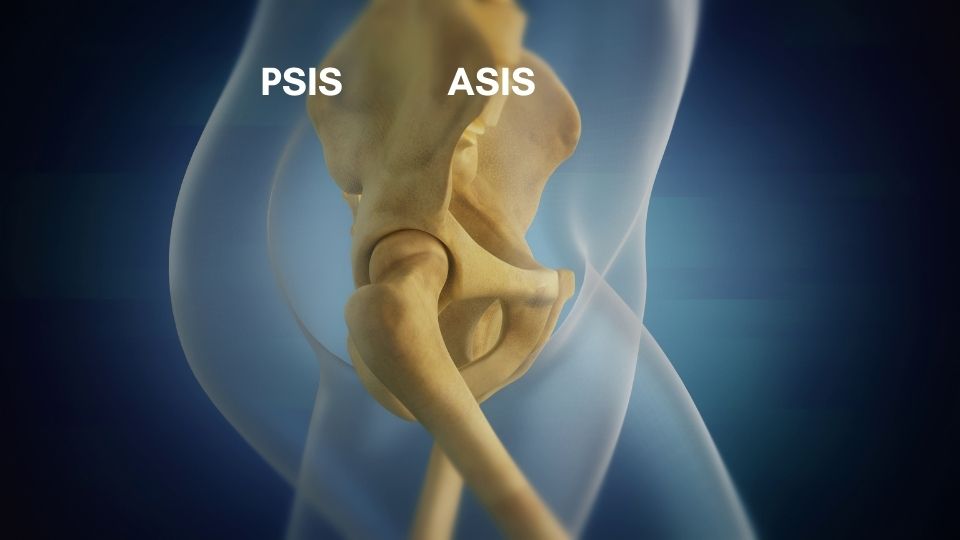 ASIS and PSIS of pelvis
