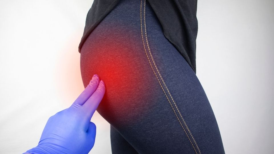 a doctor examining a piriformis syndrome patient