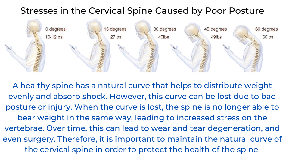 Stresses in the Cervical Spine Caused by Posture