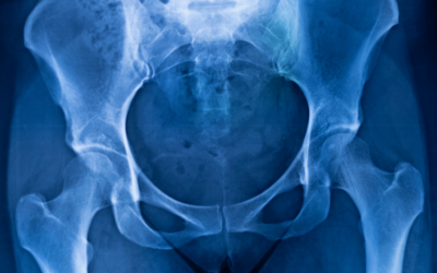 Can Hip Cartilage Repair Itself? |  Cartilage	 Damage