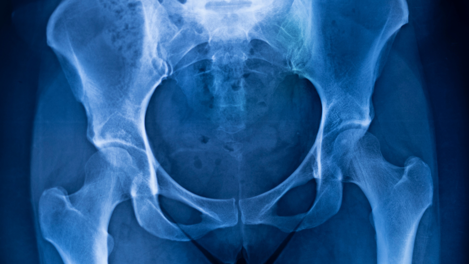 hip cartilage